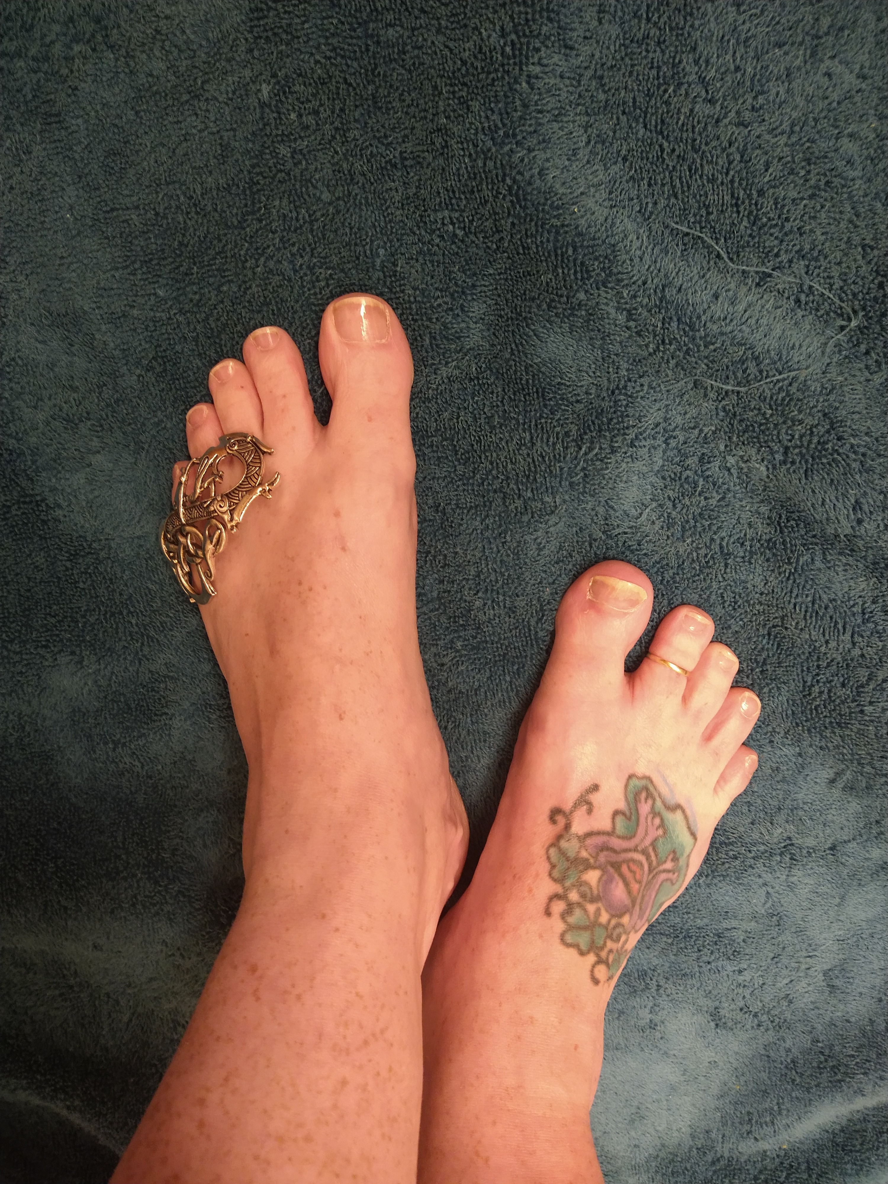freckledfroggyfeet