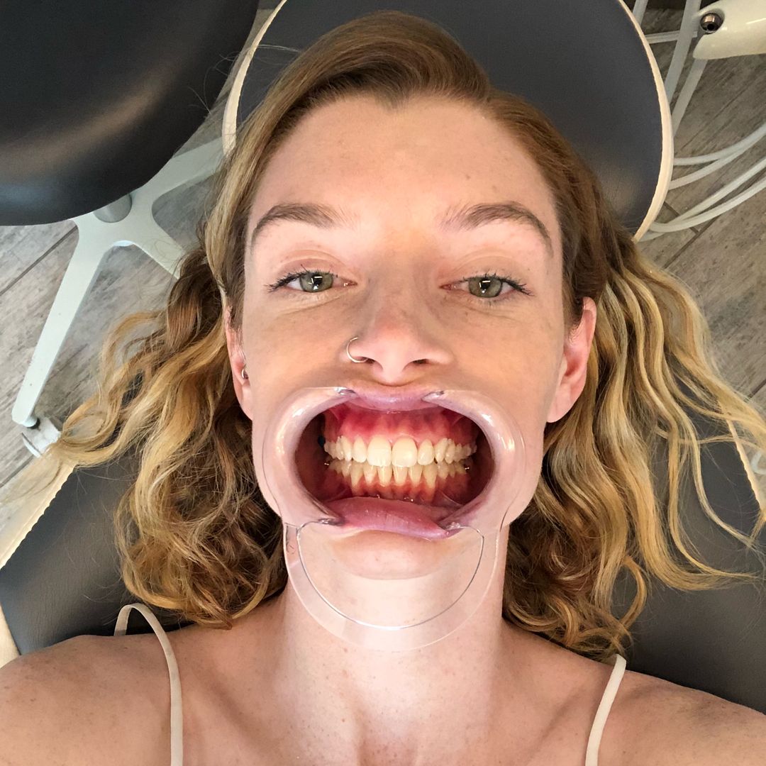 eringilfoy
